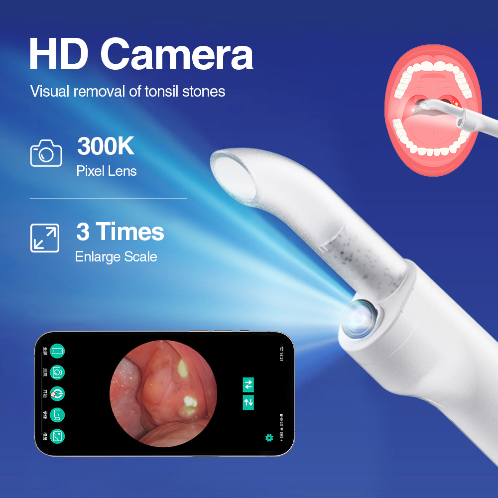 Smart Visual Tonsil Stone Remo - đánh giá và giá Lighting Visual