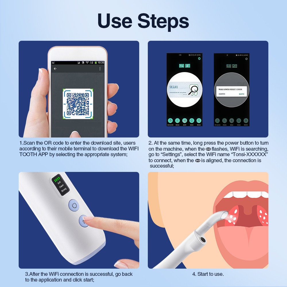 Smart Visual Tonsil Stone Remo - đánh giá và giá Lighting Visual