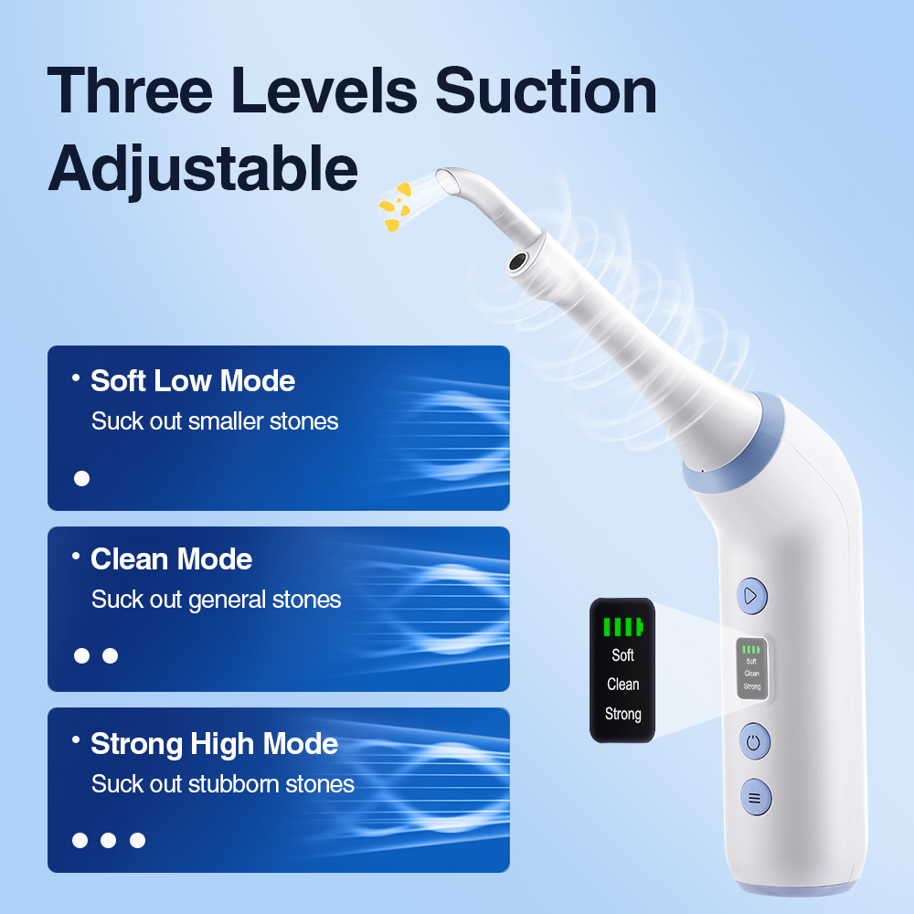 Smart Visual Tonsil Stone Remo - đánh giá và giá Lighting Visual